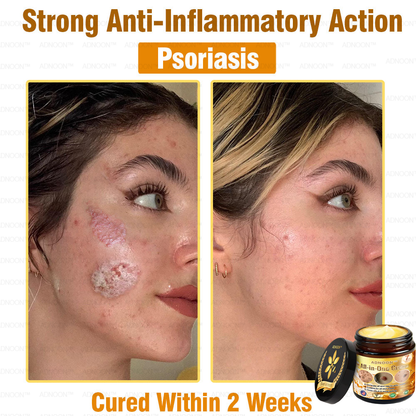 ADNOON™ Bee Venom All-in-One Cream US Dermatologist Approved