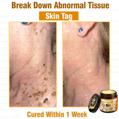 ADNOON™ Bee Venom All-in-One Cream US Dermatologist Approved