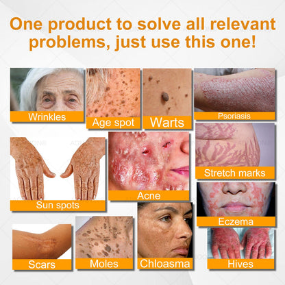ADNOON™ Bee Venom All-in-One Cream US Dermatologist Approved