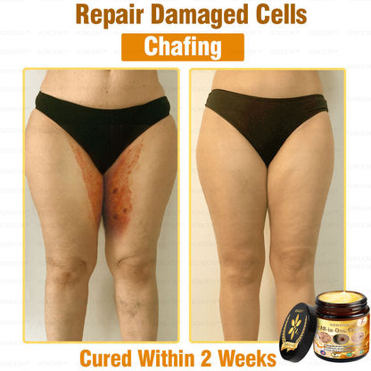 ADNOON™ Bee Venom All-in-One Cream US Dermatologist Approved
