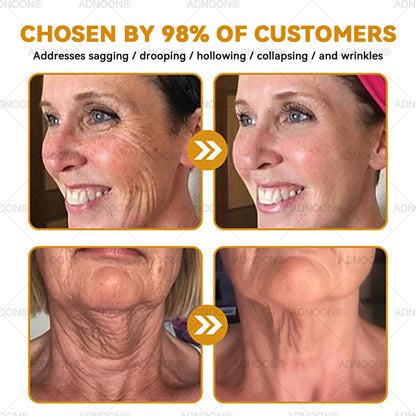 Mayo Clinic Official: ADNOON® Botox Skin Treatment Cream Anti-aging, Hydrating, Skin Repair, Even Tone, Acne and Dark Spot Treatment, Wart and Mole Removal, Psoriasis Relief