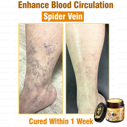 ADNOON™ Bee Venom All-in-One Cream US Dermatologist Approved