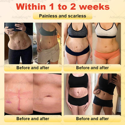 🎁 Only 5 pairs left! We're offering you an additional 50% discount! Get yourself in shape and healthy. Miss out now, and you won't have another chance until next year.