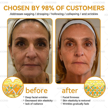 Mayo Clinic Official: ADNOON® Botox Skin Treatment Cream Anti-aging, Hydrating, Skin Repair, Even Tone, Acne and Dark Spot Treatment, Wart and Mole Removal, Psoriasis Relief
