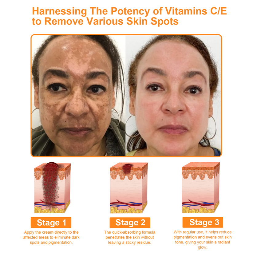 ADNOON®  7-Day Multi-Effect All-in-One Skincare Cream—Professionally Supported by AAD 👨‍⚕️