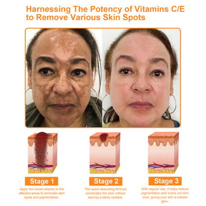 ADNOON®  7-Day Multi-Effect All-in-One Skincare Cream—Professionally Supported by AAD 👨‍⚕️
